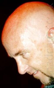 Close-up of the side of the bald head of a man, coming into frame from the right. He has a short goatee beard that stretches up to the corners of his mouth, and almost seems to be glowering at something low-down in the distance. White light shines on the side of his head, with red light illuminating the top. Black walls fill the background.